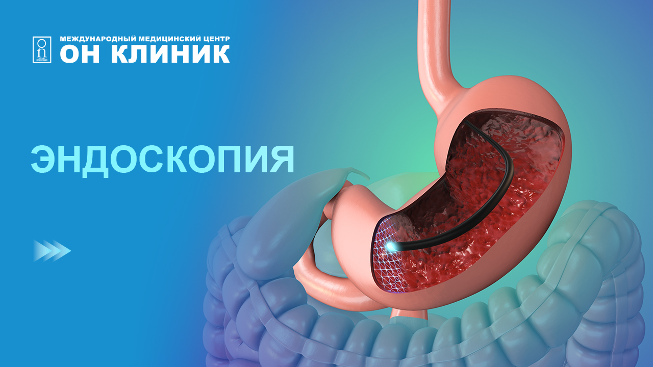 Эндоскопия