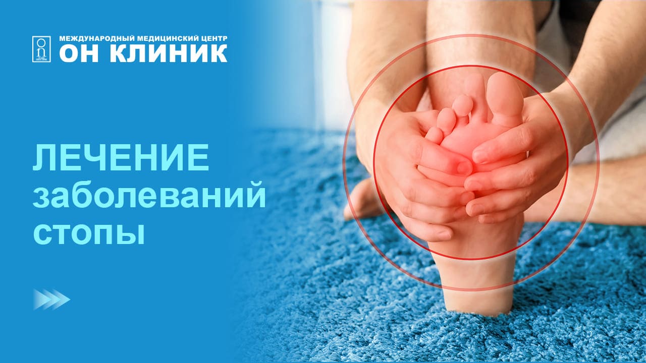 Диагностика и лечение заболеваний стопы в мецицинском центре ОН КЛИНИК в Рязани